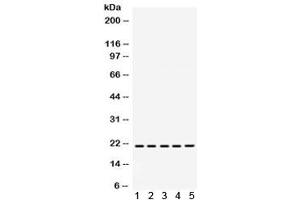 Western blot testing of 1) rat brain, 2) rat liver, 3) rat kidney, 4) human MCF7 and 5) human SW620 lysate with RAPA1 antibody.