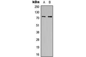 Western blot analysis of CDC16 expression in HeLa (A), HT1080 (B) whole cell lysates. (CDC16 antibody  (C-Term))