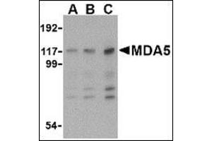 Western blot analysis of MDA5 in Daudi cell lysate with MDA5 antibody at (A) 1, (B) 2 and (C) 4 μg/ml. (IFIH1 antibody  (Center))