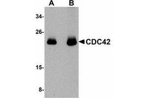 Image no. 1 for anti-Cell Division Cycle 42 (GTP Binding Protein, 25kDa) (CDC42) (N-Term) antibody (ABIN478059) (CDC42 antibody  (N-Term))