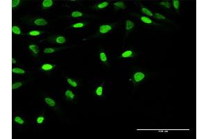 Immunofluorescence of purified MaxPab antibody to OBFC1 on HeLa cell. (OBFC1 antibody  (AA 1-368))