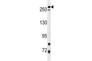 Western Blotting (WB) image for anti-Leucine-Rich Repeat Kinase 2 (LRRK2) (AA 878-909) antibody (ABIN3031607)