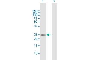 Western Blot analysis of TIMP1 expression in transfected 293T cell line by TIMP1 MaxPab polyclonal antibody. (TIMP1 antibody  (AA 1-207))