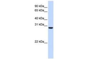 Image no. 1 for anti-Chromosome 18 Open Reading Frame 10 (C18orf10) (AA 180-229) antibody (ABIN6741302) (TPGS2 antibody  (AA 180-229))