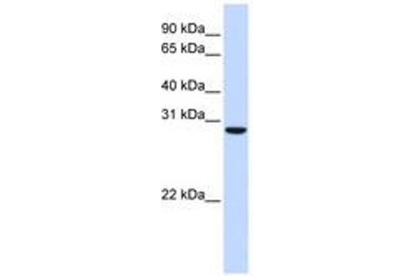 TPGS2 Antikörper  (AA 180-229)