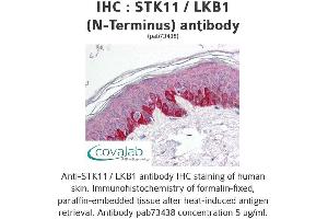 Image no. 1 for anti-serine/threonine Kinase 11 (STK11) antibody (ABIN1739721) (LKB1 antibody)