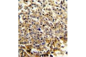 Immunohistochemistry (IHC) image for anti-Neutrophil Cytosolic Factor 4, 40kDa (NCF4) antibody (ABIN3003340) (NCF4 antibody)