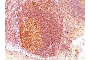 Formalin-fixed, paraffin-embedded human Tonsil stained with MALT1 Mouse Monoclonal Antibody (SPM578)
