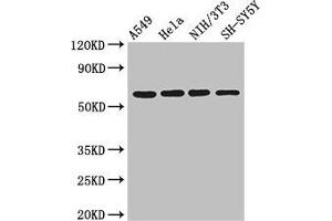 Western Blot Positive WB detected in: A549 whole cell lysate, Hela whole cell lysate, NIH/3T3 whole cell lysate, SH-SY5Y whole cell lysate All lanes: IRF5 antibody at 3 μg/mL Secondary Goat polyclonal to rabbit IgG at 1/50000 dilution Predicted band size: 57, 58, 55, 48, 18 kDa Observed band size: 57 kDa (IRF5 antibody  (AA 214-395))