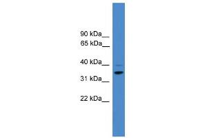 WB Suggested Anti-CCNH Antibody Titration:  0.