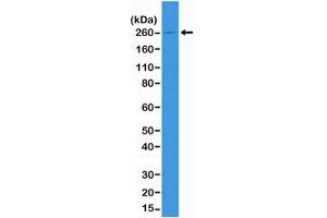 Western blot of A431 cell lysate using recombinant ACC antibody at 1:1000.