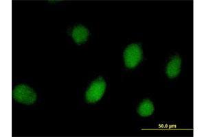 Immunofluorescence of purified MaxPab antibody to PEPP-2 on HeLa cell. (RHOXF2 antibody  (AA 1-288))