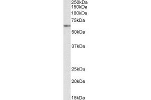 ABIN4902794 (2µg/ml) staining of K562 nuclear lysate (35µg protein in RIPA buffer). (VRK2 antibody)
