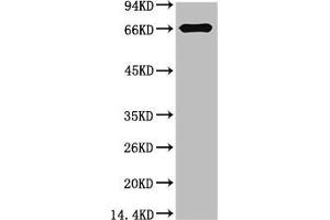 Western blot analysis of Bovine Serum Albumin using Bovine Serum Albumin Monoclonal Antibody.