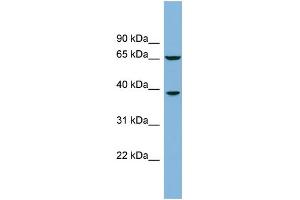 WB Suggested Anti-RLBP1L1 Antibody Titration: 0.