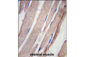 Formalin-fixed and paraffin-embedded human skeletal muscle tissue reacted with PHPT1 polyclonal antibody  , which was peroxidase-conjugated to the secondary antibody, followed by DAB staining. (PHPT1 antibody  (N-Term))