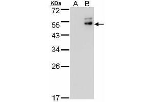WB Image Western Blot analysis of DPF2 expression in transfected 293T cell line by DPF2 polyclonal antibody. (DPF2 antibody  (Center))