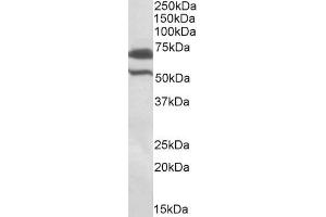 ABIN571243 (1µg/ml) staining of Rat Testis lysate (35µg protein in RIPA buffer). (BIRC3 antibody  (Internal Region))