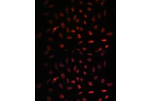 Immunofluorescence analysis of U-2 OS cells using NXT2 antibody (ABIN6133260, ABIN6144977, ABIN6144978 and ABIN6217951) at dilution of 1:100. (NXT2 antibody  (AA 110-180))
