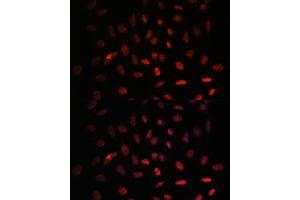 Immunofluorescence analysis of U-2 OS cells using NXT2 antibody (ABIN6133260, ABIN6144977, ABIN6144978 and ABIN6217951) at dilution of 1:100. (NXT2 antibody  (AA 110-180))