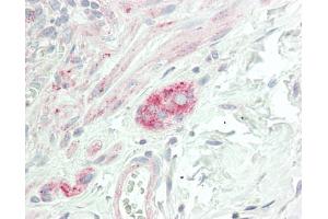 Immunohistochemistry (Paraffin-embedded Sections) (IHC (p)) image for anti-Cholinergic Receptor, Nicotinic, alpha 9 (Neuronal) (CHRNA9) (AA 8-42) antibody (ABIN2739949)