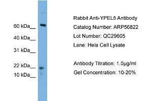 WB Suggested Anti-YPEL5  Antibody Titration: 0. (YPEL5 antibody  (N-Term))