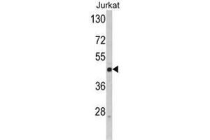 Western blot analysis of SELL Antibody (C-term) in Jurkat cell line lysates (35ug/lane). (L-Selectin antibody  (C-Term))