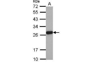 WB Image Sample (30 ug of whole cell lysate) A: PC-3 12% SDS PAGE antibody diluted at 1:2000 (Elastase 3A antibody)