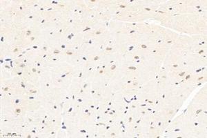 Immunohistochemistry analysis of paraffin-embedded mouse heart using,PPM1G (ABIN7075287) at dilution of 1: 3000 (PPM1G antibody)
