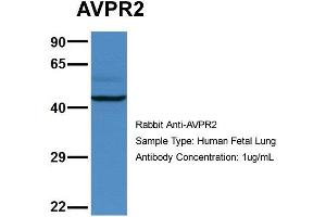 Western Blotting (WB) image for anti-Arginine Vasopressin Receptor 2 (AVPR2) (C-Term) antibody (ABIN2788110)