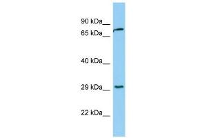 WB Suggested Anti-KLK2 Antibody Titration:  0. (Kallikrein 2 antibody  (Middle Region))