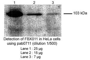Image no. 1 for anti-F-Box Protein 11 (FBXO11) (Internal Region) antibody (ABIN559708) (FBXO11 antibody  (Internal Region))