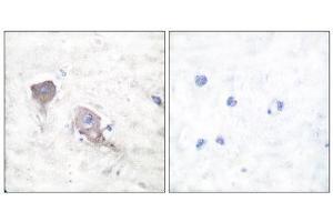 Immunohistochemistry (IHC) image for anti-Synaptosomal-Associated Protein, 25kDa (SNAP25) (C-Term) antibody (ABIN1848775) (SNAP25 antibody  (C-Term))