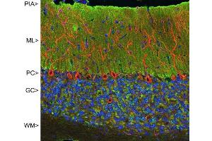 Confocal image of adult rat cerebellar cortex stained with MCA- 2D11 (green), chicken polyclonal antibody to MAP2 CPCA-MAP2 (red) and DNA (blue). (VSNL1 antibody)