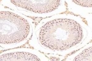 Immunohistochemistry (Paraffin-embedded Sections) (IHC (p)) image for anti-Transcriptional Adaptor 2B (TADA2B) antibody (ABIN7075957)