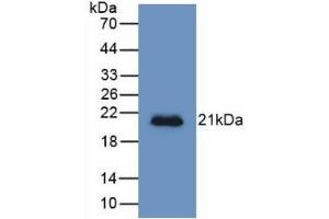 Detection of Recombinant HJV, Human using Monoclonal Antibody to Hemojuvelin (HJV) (HFE2 antibody  (AA 234-416))