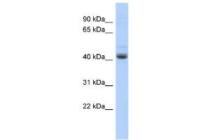 WB Suggested Anti-PKNOX1 Antibody Titration:  0. (PKNOX1 antibody  (Middle Region))