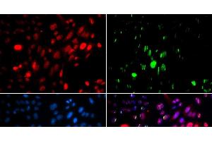 Immunofluorescence analysis of U2OS cells using Phospho-ABL1(Y204) Polyclonal Antibody (ABL1 antibody  (pTyr204))