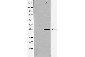 Western blot analysis of extracts of HepG2 , using CFHR1 antibody. (CFHR1 antibody  (C-Term))