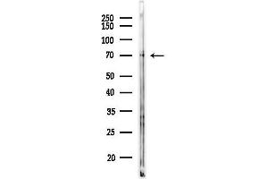 anti-Solute Carrier Family 5 (Iodide Transporter), Member 6 (SLC5A6) (C-Term) antibody