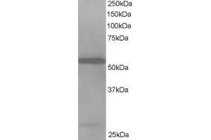 ABIN184747 staining (1µg/ml) of Jurkat lysate (RIPA buffer, 35µg total protein per lane).
