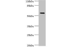 Western blot All lanes: ACBD5 antibody at 2 μg/mL + Hela whole cell lysate Secondary Goat polyclonal to rabbit IgG at 1/10000 dilution Predicted band size: 61, 55, 59, 47 kDa Observed band size: 61 kDa (ACBD5 antibody  (AA 1-461))