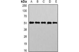Western blot analysis of PIST expression in HepG2 (A), Hela (B), mouse kidney (C), mouse liver (D), rat brain (E) whole cell lysates. (GOPC antibody)