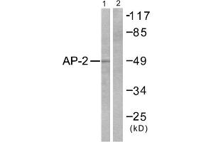 Western blot analysis of extracts from COLO205 cells, using AP-2 antibody. (TFAP2A antibody  (C-Term))