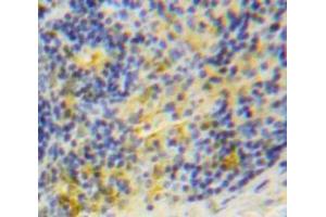 Used in DAB staining on fromalin fixed paraffin-embedded Spleen tissue (TRAF1 antibody  (AA 169-392))