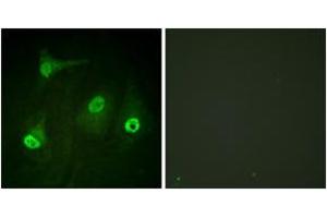 Immunofluorescence analysis of HeLa cells, using NF-kappaB p65 (Acetyl-Lys310) Antibody. (NF-kB p65 antibody  (acLys310))