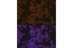 Immunofluorescence (IF) image for anti-Phospholipase C gamma 2 (PLCG2) antibody (ABIN7269342)