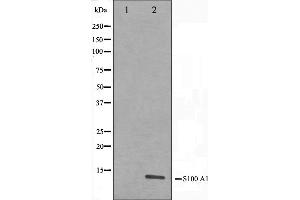 Western blot analysis on A549 cell lysate using S100 A1 Antibody,The lane on the left is treated with the antigen-specific peptide. (S100A1 antibody  (N-Term))