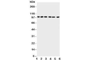 Western Blotting (WB) image for anti-Protein Inhibitor of Activated STAT, 1 (PIAS1) (AA 636-651) antibody (ABIN3032369)