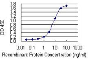 Detection limit for recombinant GST tagged FOXP1 is 0. (FOXP1 antibody  (AA 1-114))